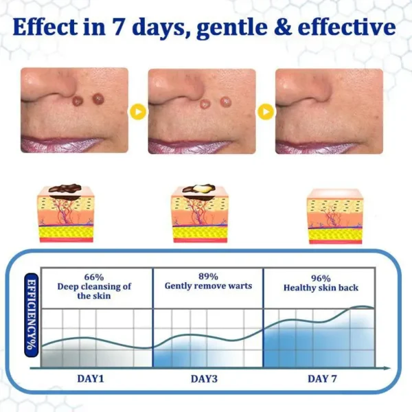 LOVILDS® BeeDerm RX Cream