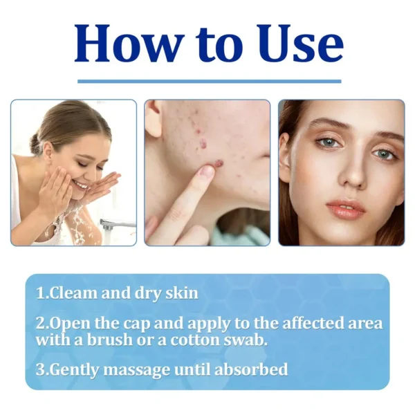 LOVILDS® BeeDerm RX Cream