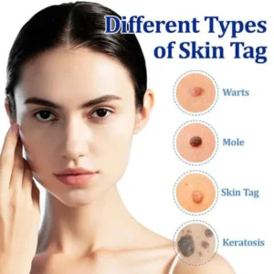 LOVILDS® BeeDerm RX Cream