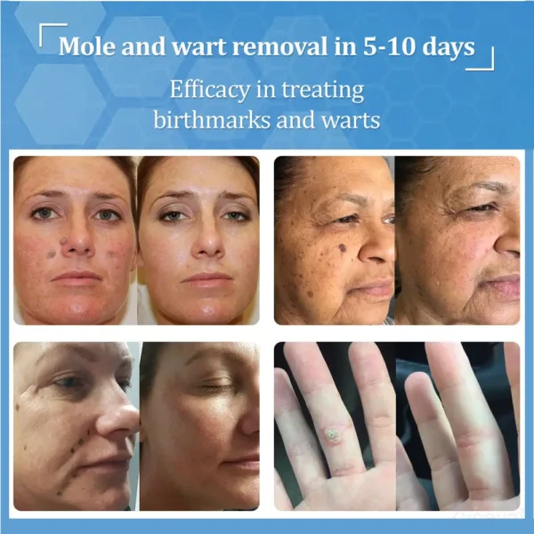 LOVILDS® BeeDerm RX Cream