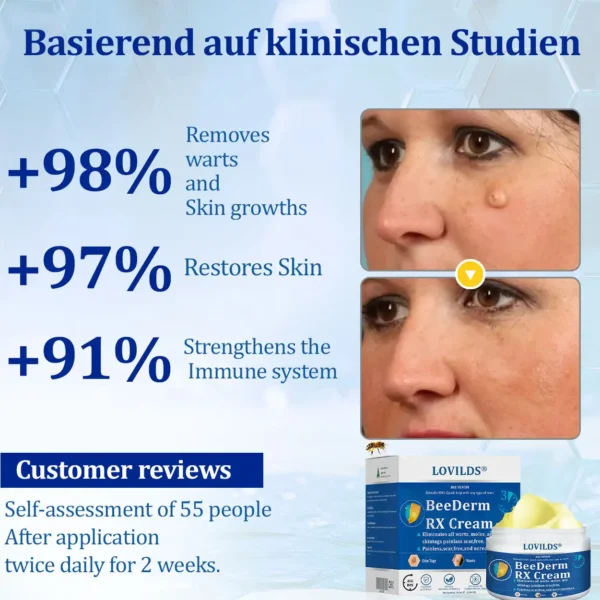 LOVILDS® BeeDerm RX Cream