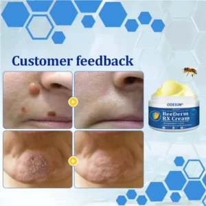 ODEIUN® BeeDerm RX Cream