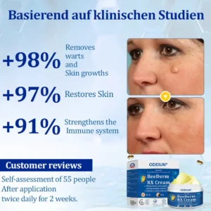 ODEIUN® BeeDerm RX Cream