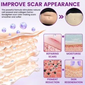 Timilk® ScarVanisher Scar Gel