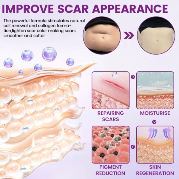 Timilk® ScarVanisher Scar Gel