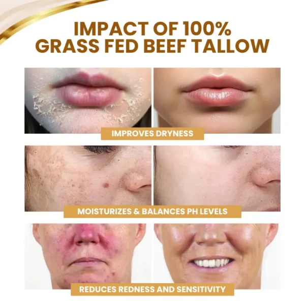 Timilk® DermSerene Beef Tallow Honey Balm