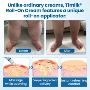 Timilk® Lymphora Swelling Relief Roll-On