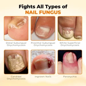 Timilk® NailRevive Bee Venom Anti-fungi Solution