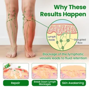 Timilk® VenoLift Leg Relief Spray