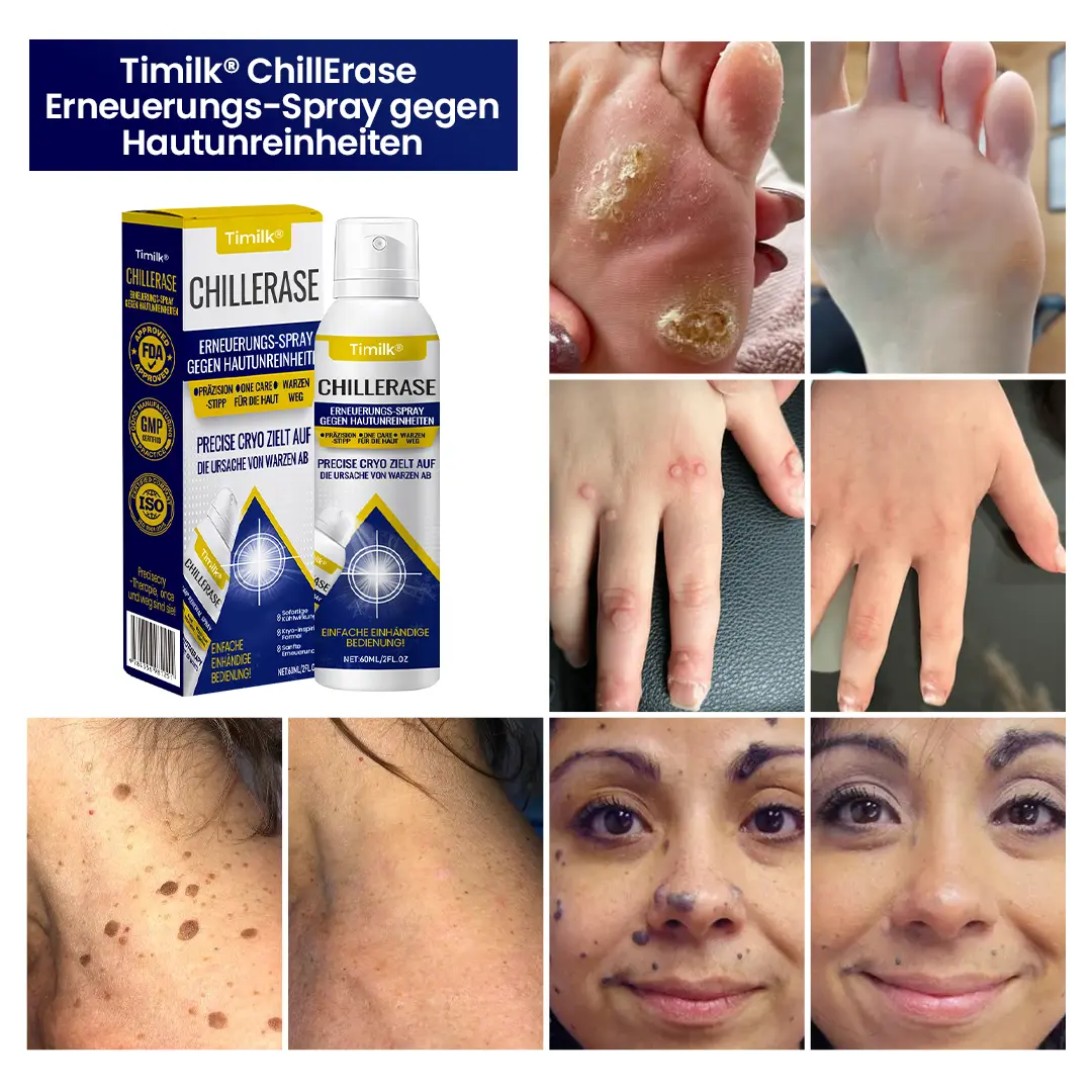 Timilk® ChillErase Erneuerungs-Spray gegen Hautunreinheiten