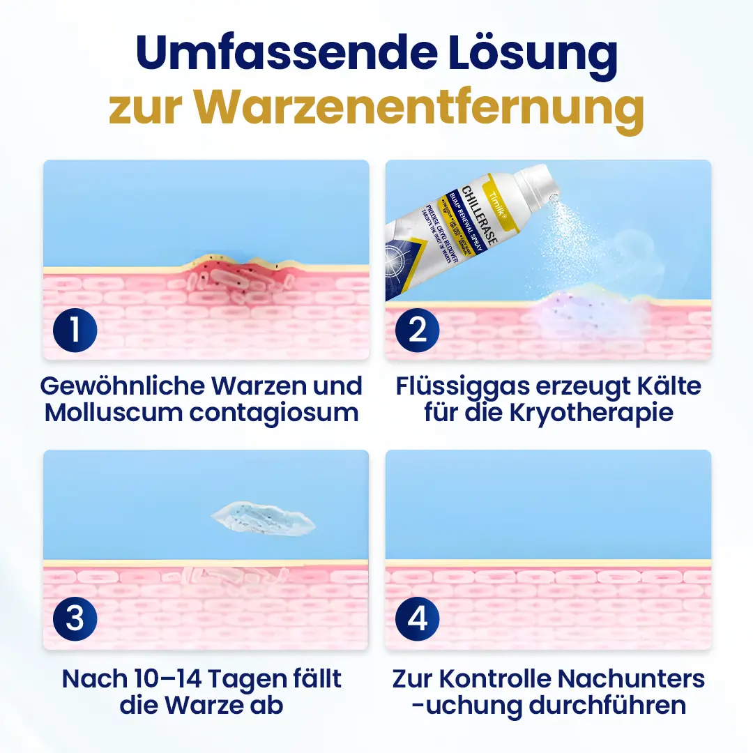 Timilk® ChillErase Erneuerungs-Spray gegen Hautunreinheiten