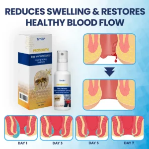 Timilk® ProSooth Bee Venom Hemorrhoids Spray