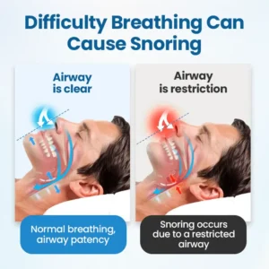 Timilk® SnoreLess Nasal Breather