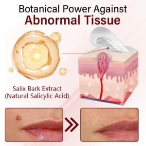 Timilk® Vionara Nano WartErase Patch