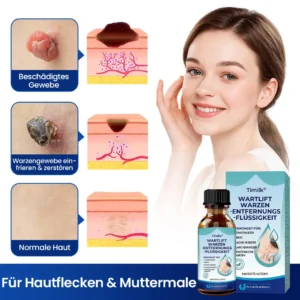 Timilk® WartLift Warzen-Entfernungsflüssigkeit⚕️