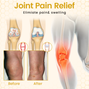 Timilk® VenomFlex Bee Therapy Cream