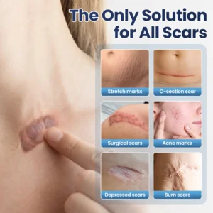 Alisanda® Texture Repair Gel