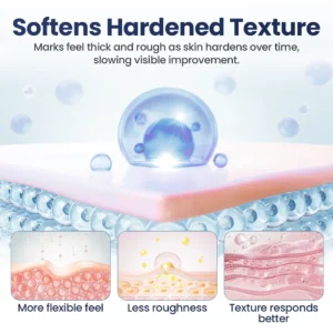 Alisanda® Texture Repair Gel