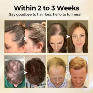 Timilk® CollagenGrow Peptides Hair Growth Spray