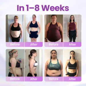 Timilk® Nano Micro-Delivery Slim Patch — Moringa·Berberine x NAD+ 10-in-1