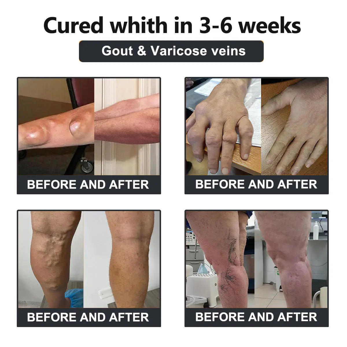 Vioralifes™ Bee Venom and Turmeric Joint and Bone Pain Relief Cream