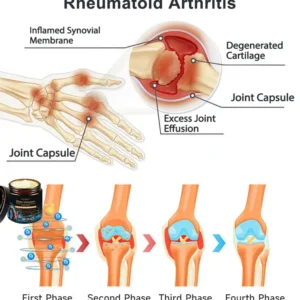 Vioralifes™ Bee Venom and Turmeric Joint and Bone Pain Relief Cream