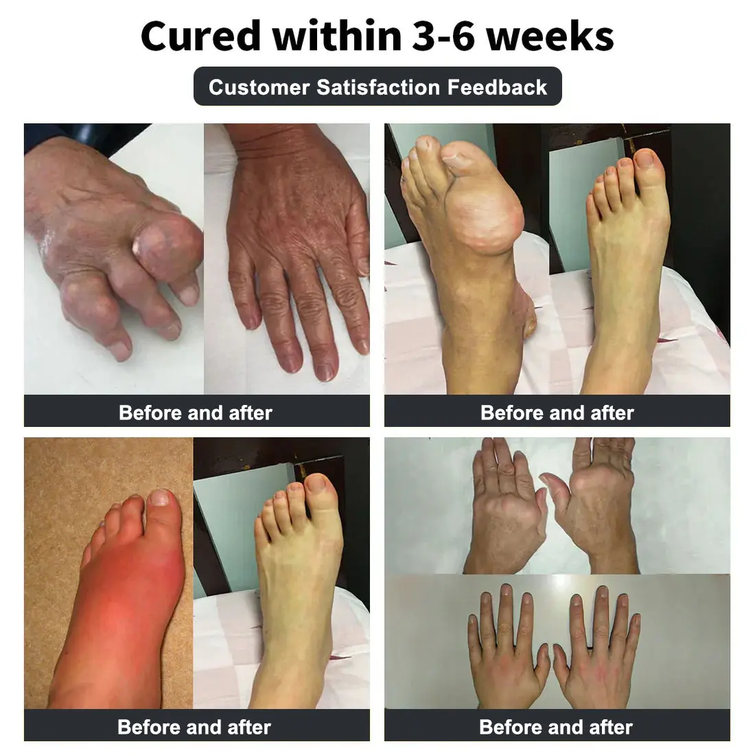 Vioralifes™ Bee Venom and Turmeric Joint and Bone Pain Relief Cream