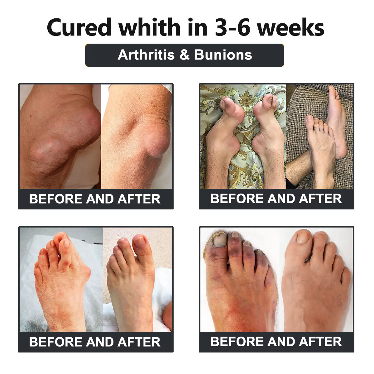 Vioralifes™ Bee Venom and Turmeric Joint and Bone Pain Relief Cream