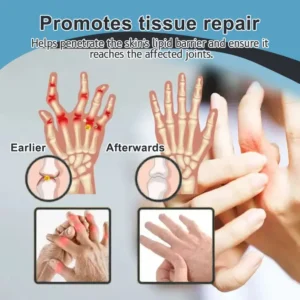 Vioralifes™ Bee Venom and Turmeric Joint and Bone Pain Relief Cream