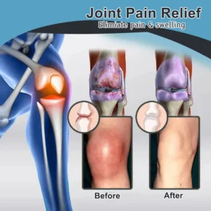 Vioralifes™ Bee Venom and Turmeric Joint and Bone Pain Relief Cream