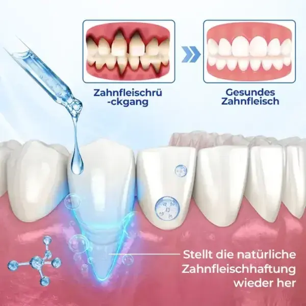 Biancat® BeeTakt Zahnfleisch-Repair Lösung