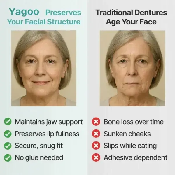 Yagoo™ Medical Full Denture with Strong Suction