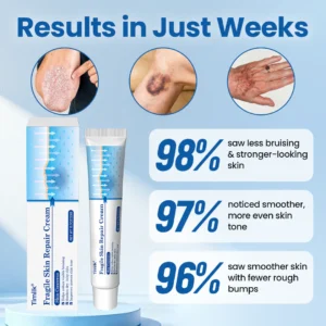 Fragile Skin Repair Cream