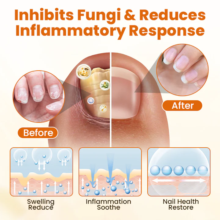 Timilk® FungiBee Advanced Nail Repair Spray