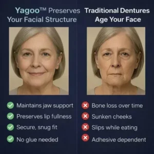 Yagoo™ PREMIUM FULL DENTURE SET