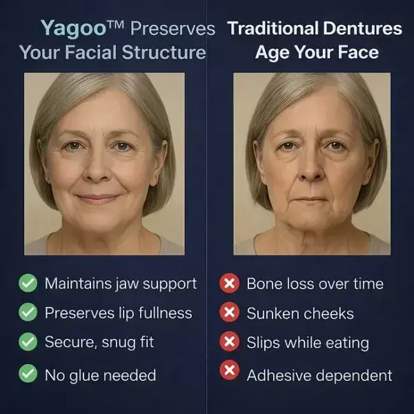Yagoo™ PREMIUM FULL DENTURE SET